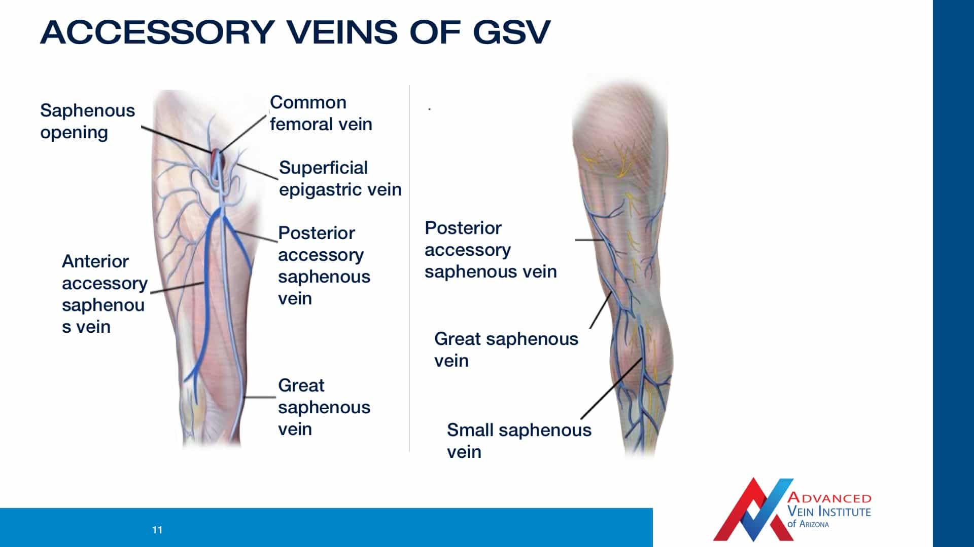 superficial femoral vein anatomy