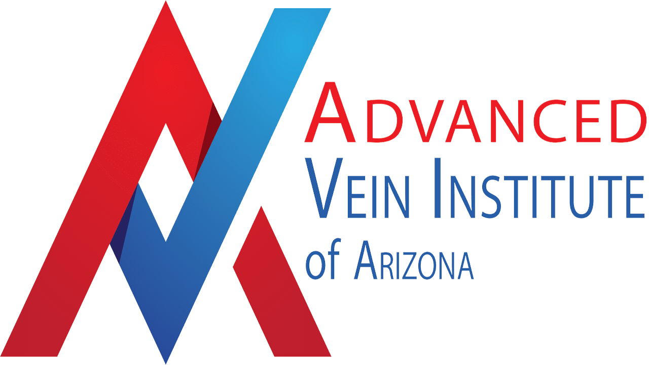 Varicose Vein Treatment in Tempe